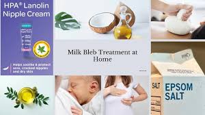 How to treat Milk Blebs : Breastfeeding Moms