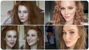 Check spelling or type a new query. Elcin Sangu Estetik Oncesi Sonrasi Dogru Ve Guncel Hayattan Haberler