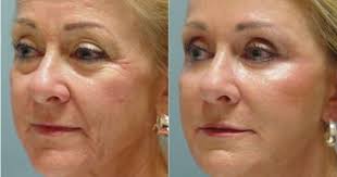 Red Light Therapy Hollywood Beauty Secrets Beauty Recipes Paraben Free Products Light Therapy Mask Light Therapy Red Light Therapy