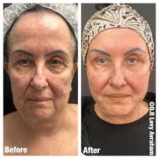 דר לוי אברהם‎ (@dr_levy_avraham) • Instagram photos and videos