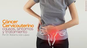 La verdad es que la mayoría de las personas por lo general tenemos un poco de miedo e indagar esas afecciones que son difíciles de superar como tal. Cancer Cervicouterino Causas Sintomas Y Tratamiento Por Dr Roberto Ivan Lopez Youtube
