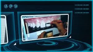 pin on 4d smile design