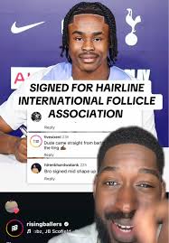 Cole Anthony Hairline