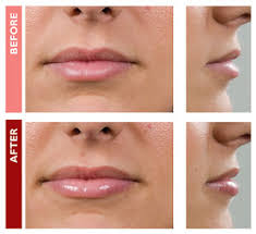 Lip Plumper Lip Gloss