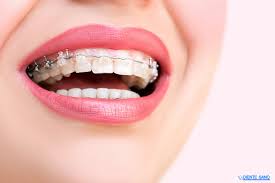 Check spelling or type a new query. Sapphire Braces Orthodontics In Barcelona Diente Sano Dental Clinic In Barcelona
