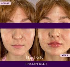 Rogue Mens Aesthetics We are your premier destination for men's facial  treatments. Specialising in tailored aesthetics, we offer a range of  services including facials, skin rejuvenation and anti-aging therapies  designed specifically for