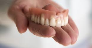 When you fill out our form at onlinedenturesmile.com, you will be on your way to buying dentures online! How Implant Retained Dentures Work