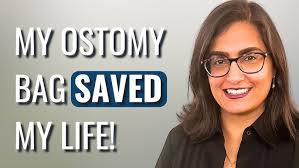 I Hid My Ostomy Bag For 15 Years!