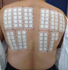 Image result for Patch Testing