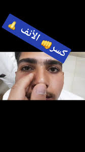 فيديو توضيحي للكشف علي الجيوب الأنفية