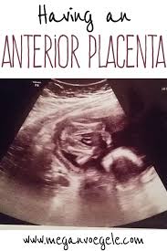 Having An Anterior Placenta Megan Voegele Anterior Placenta Placenta 24 Weeks Pregnant