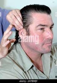 TV chef Ross Burden undergoing an acupuncture procedure at the Hale clinic  in London with Nick Dalton Brewer Stock Photo