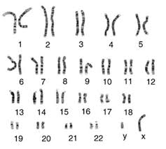 karyotype genetic disorders