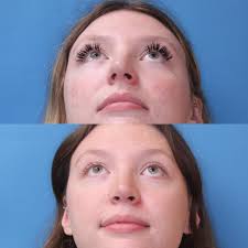 Facial Plastics happy hour with Dr Greg Branham of @washu.ent. We discuss  interesting cases…but mostly we retell some unforgettable stories!