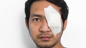 Equal-Eyes: Non-Prescription Lazy Eye Treatment For Adults