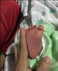 Saya ingin menceritakan pengalaman nyata saya. Pengalaman Bersalin Anak Ketiga