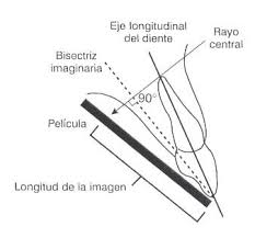 Resultado de imagen para RAYOS X DENTAL HISTORIA CONO LARGO