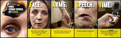 Fitness, natural remedies, conditions and symptoms When Stroke Strikes Act Fast