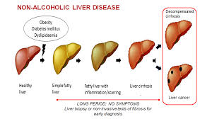 If you're itching and have jaundice, it's not a good story, he says. Eit Health