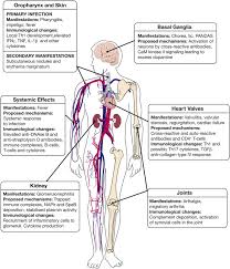 Image result for Poststreptococcal Reactive Arthritis