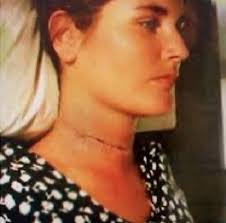 Unbroken: The Remarkable Survival Story of Alison Botha