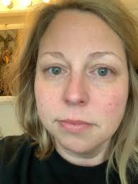 How amazing are Tammy's results after just two weeks of using our Camp Lane  Retinol Eye Balm?! 😍✨ She was hesitant at first but gave it a go and the  results speak