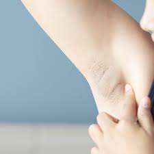 Typically, the nodule will feel firmer than the rest of the thyroid gland. Axillary Lymphadenopathy Overview And More