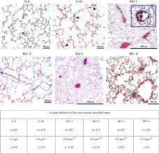 Browse the use examples 'parenchyma of lung' in the great english corpus. Histological Sections Of The Lung Parenchyma From Normal Control Rats Download Scientific Diagram