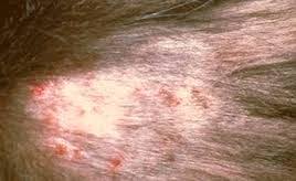 Fad or flea allergy dermatitis is the most common skin disease amongst cats. Flea Bites On Cats And Dogs Symptoms And Treatments Fleas And Flea Bites