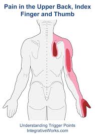 Pin On Acupuncture For Pain Relief