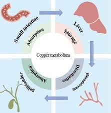 Image result for Copper Poisoning