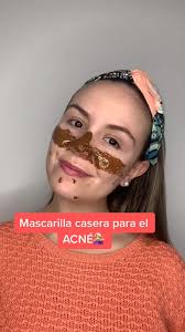 Mascarilla casera para el ACNÉ