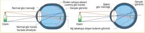 Goz Kusurlari