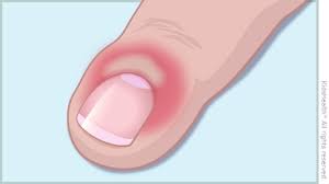 Un total de 55.000 personas murieron en españa el año pasado. Paroniquia