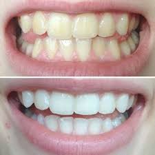 過炭酸ナトリウムでつくる殺菌 漂白ペーストが便利すぎる ナチュラル掃除 洗濯に esseonline エッセ オンライン 歯 ホワイトニング 重曹 歯磨き ホワイトニング