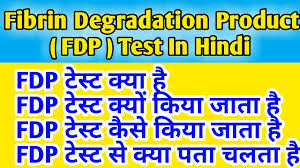 Demonstration of clinical examination of the hand for finger flexion Fibrin Degradation Product Fdp Test Youtube
