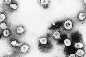 La infección por virus sincicial respiratorio (vsr) provoca. Eurico Arruda Um Admirador Dos Virus Revista Pesquisa Fapesp