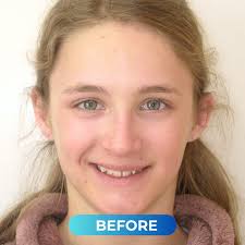 Your smile is your signature—make it unforgettable! 🌟 Start your journey  with Cusimano Orthodontics and let us help you achieve a smile that's all  your own. #SmileGoals #BeYou #Braces #Nampa #NampaIdaho