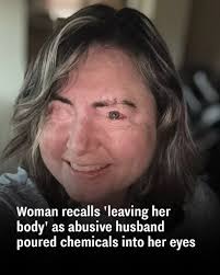 She wants to raise awareness about domestic violence.