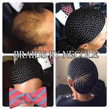 14 Extraordinary Alopecia Camouflage Cornrows By Braids By Necole Alopecia Hairstyles Braids For Thin Hair Braided Updo Cornrows