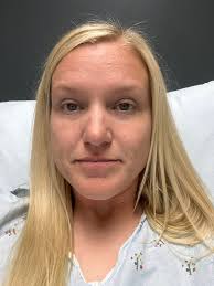 I have pains in my lower back and cramps in my pelvis area.I had a  hysterectomy over 2 years ago for history of endometriosis and a cyst.Now  the pain has came back