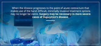 Check spelling or type a new query. Home Remedies To Treat Dupuytren S Disease Orthobethesda