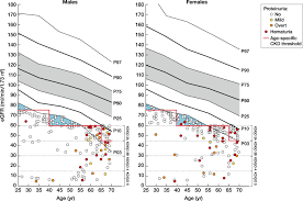 Definition and meaning were removed to avoid. How To Interpret An Estimated Glomerular Filtration Rate Egfr In 2020 Kidney International