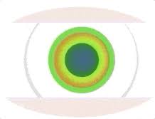 Just be aware that while many wearers will get used to their new glasses in two to three days, a significant change in your eyeglass prescription, a change to your progressive lenses, or getting your first eyeglass prescription can result in an adjustment period that lasts up to two weeks. Decision Guide Progressive Glasses Vs Multifocal Contacts