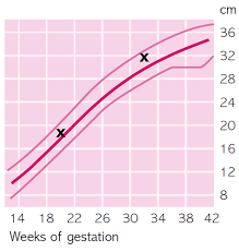 Welcome To Your Third Trimester Part 9 Doppler Scans