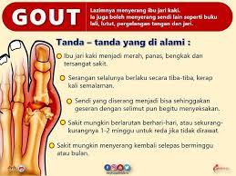 Orang yang bertelanjang kaki atau sering mengenakan sandal cenderung memiliki ibu jari kaki yang terpisah dari lainnya. Tahu Tak Gout Menyerang National Campaign Unofficial Facebook