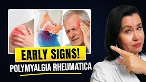 Image result for Polymyalgia Rheumatica