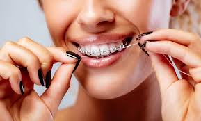 So, you must know how to floss your teeth with braces that can fulfill the basic need of your teeth. How To Use Dental Floss With Braces