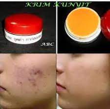 To see photos and videos that disappear after 24 hours, sign up. Krim Kunyit Missaish Beauty