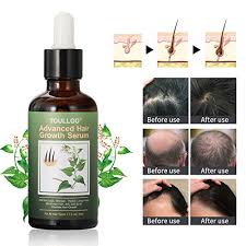 Our quality is in a class of its own especially because we don't have any useless fillers or harmful chemicals! Hair Growth Serum Hair Loss Treatments Hair Serum Hair Growth Oil For Thicker Longer Fuller Healthier Hair Help Hair Follicle Growth Prevent Hair Loss Thinning With Natural Vitamin Rich Treatm